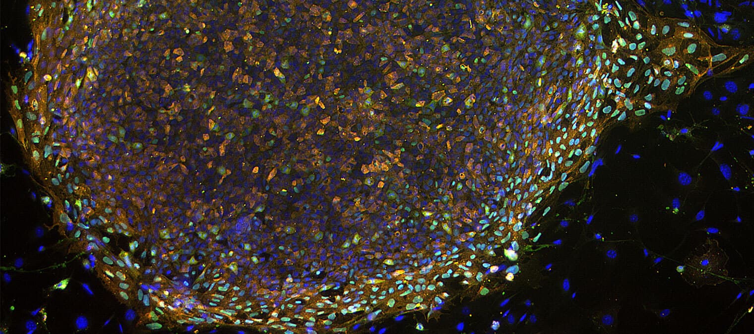 Meet your stem cells and major breakthroughs in research