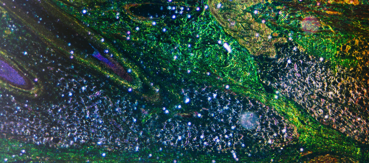 What causes mitochondrial dysfunction?